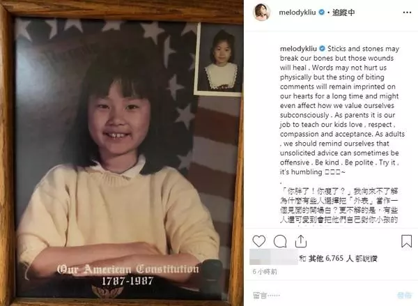 遭長輩嫌黑又胖! 隔32年…Melody曬對比照反擊:長大了會不一樣