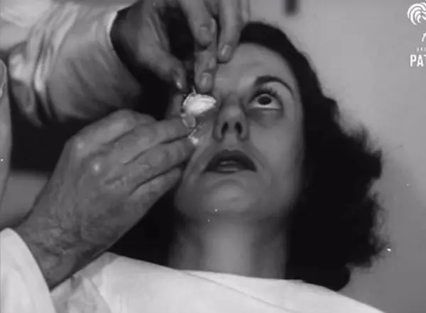 1948年第一副隱形眼鏡...你絕對無法想像的驚悚..整個佩戴過程竟然如此駭人!