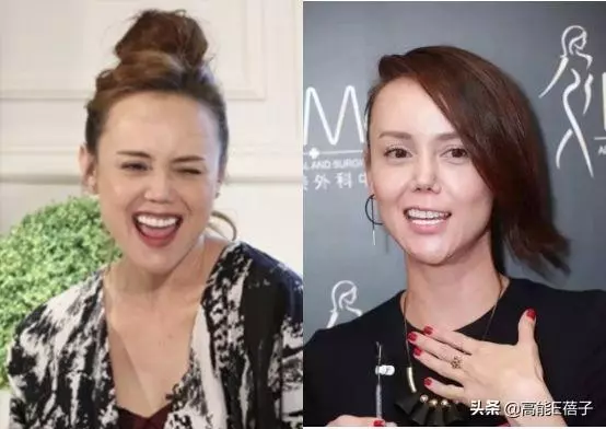 最美亞姐韓君婷自嘲美不過楊恭如,網友:你的鼻子是回爐重造了嗎?
