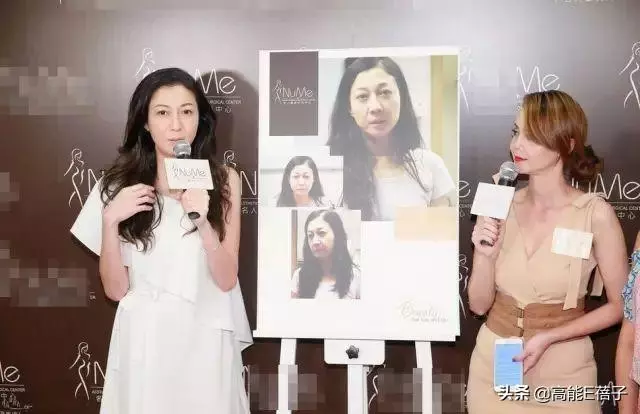最美亞姐韓君婷自嘲美不過楊恭如,網友:你的鼻子是回爐重造了嗎?