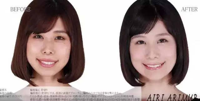 5年花費100萬整容無數次,這個日本網紅只為向父親證明一件事!