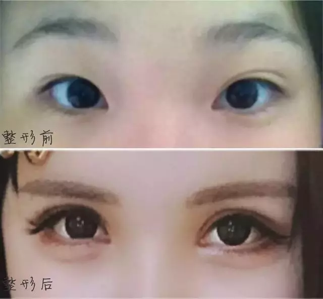 5年花費100萬整容無數次,這個日本網紅只為向父親證明一件事!