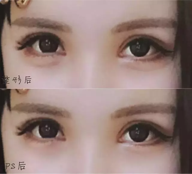 5年花費100萬整容無數次,這個日本網紅只為向父親證明一件事!