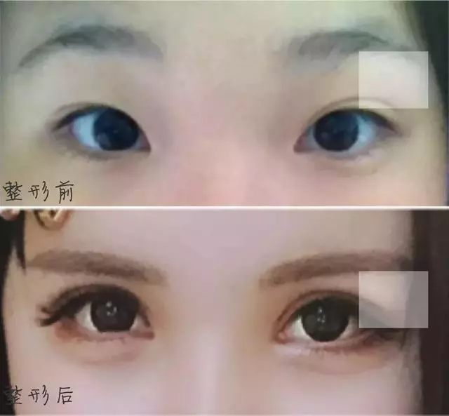 5年花費100萬整容無數次,這個日本網紅只為向父親證明一件事!