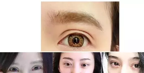 5年花費100萬整容無數次,這個日本網紅只為向父親證明一件事!
