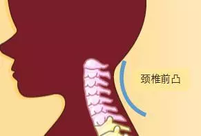 終於找到頸痛頭痛的「罪魁禍首」,專家說:此方法可以逆轉頸椎變直的,快速活血緩解疼痛,遠離頸椎病