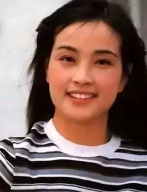玻尿酸是填充劑不是防腐劑,用量過度的女星,你還忍心看嗎?