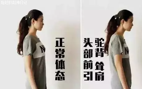 開始健身之前,先把駝背治好,勤練5個動作,駝背改善很明顯