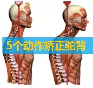 開始健身之前,先把駝背治好,勤練5個動作,駝背改善很明顯