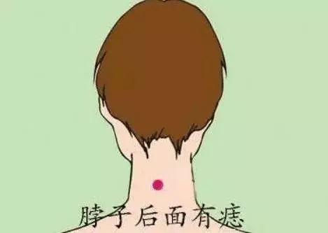 身上10大好運痣,男成龍,女成鳳,坐擁有萬貫家財!