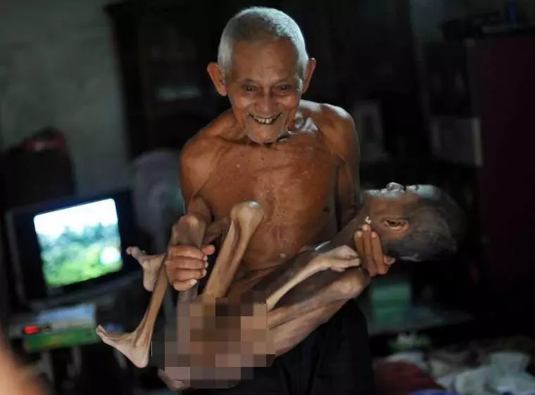 掉淚!17歲「活骷髏」少年嚇跑父母,88爺爺數十年如一日照顧!!