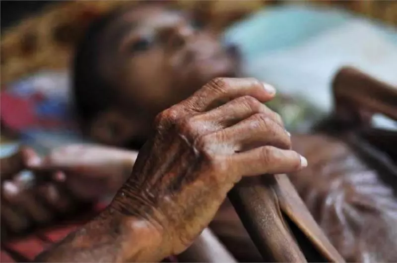掉淚!17歲「活骷髏」少年嚇跑父母,88爺爺數十年如一日照顧!!