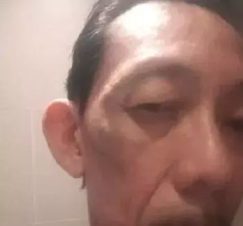 洋漢暴打60歲安哥至右眼紅腫、脖子扭傷…差點提前退休!他竟然還是新加坡PR
