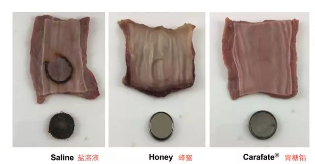 能救命!孩子誤吞了紐扣電池,最有效的急救方法