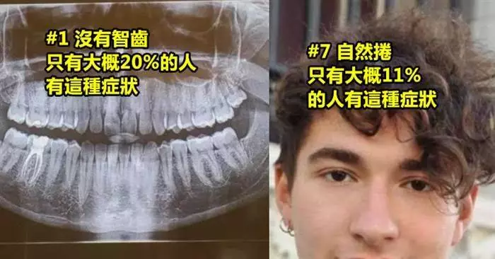 只有被上帝眷顧才會擁有的12種「超罕見身體特徵」!一起來看看吧!