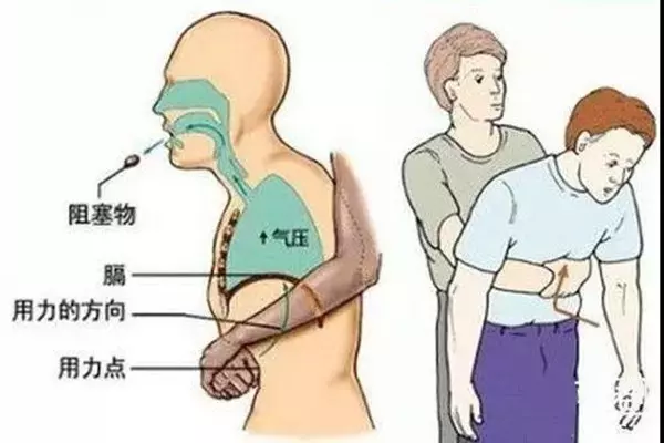 女兒莫名其妙瘦成一根柴,送檢查醫生叫把項鍊拿掉!母回:根本沒戴!醫生:糟了,快動手術