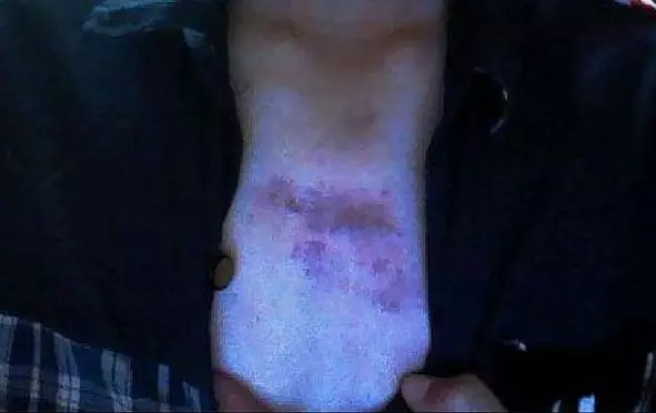 情侶「親熱」後,男友不慎死亡,查明「兇器」,女友尷尬不已,原來是這個動作害了他……