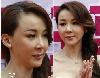 當50歲邱淑貞撞上50歲的蕭薔,整和沒整容,差距一目了然!