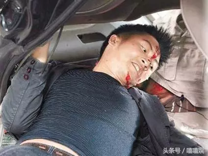 超敬業明星!鼻子打斷掰回來接著拍,被蛇咬堅持上台毒發身亡!!