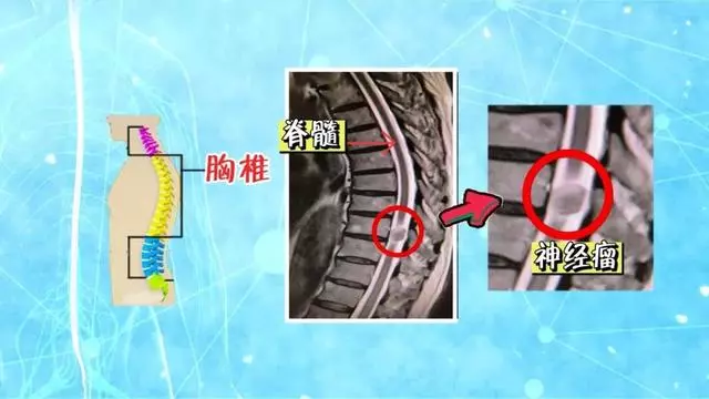 疼痛、麻木、發冷?醫生:跟我學緩解頸椎鍛煉方法和腰椎鍛煉方法