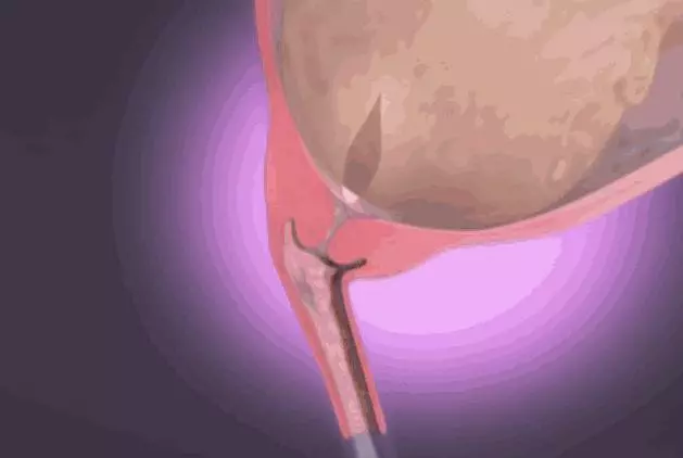 順產到底有多痛?女人到底有多不容易?老公看完18張圖,說:不生了