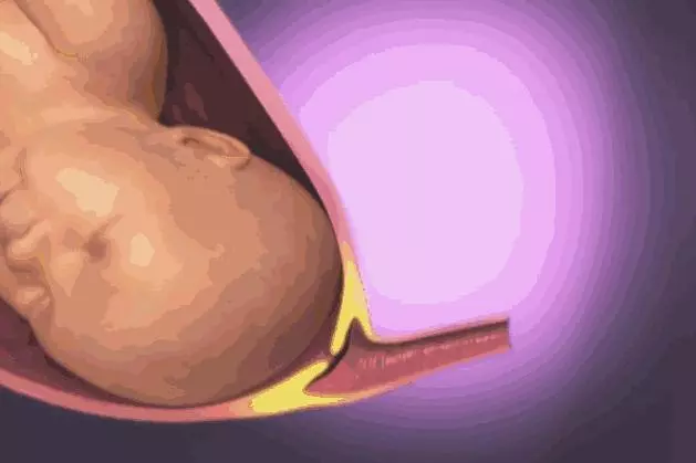 順產到底有多痛?女人到底有多不容易?老公看完18張圖,說:不生了