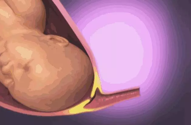順產到底有多痛?女人到底有多不容易?老公看完18張圖,說:不生了