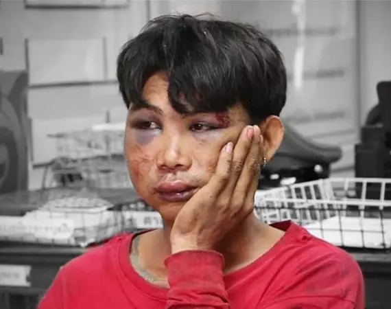 《活該》照片看起來真的很像豬頭!強壓23歲孕婦進草叢「」性侵「」 「」色狼「」遭正義哥毆打變「豬頭」!