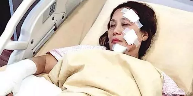 股骨磨損要做手術換骨!61歲前TVB女星直言:轉做幕後走路太多了