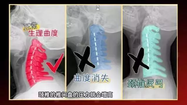酒店房間為什麼要放4個枕頭?90%的人竟然都不知道!