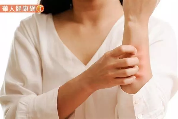 皮膚癢=肝不好、排毒功能差?中醫教你養好肝