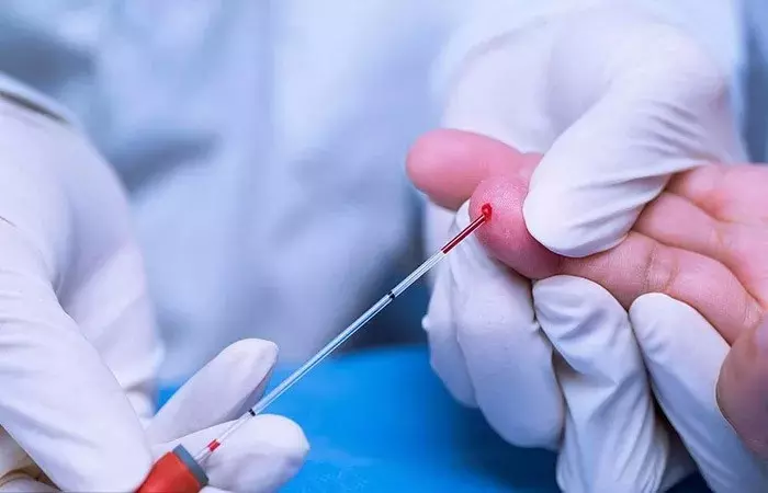 總膽固醇與高密度脂蛋白比例合理,心血管才能更健康!