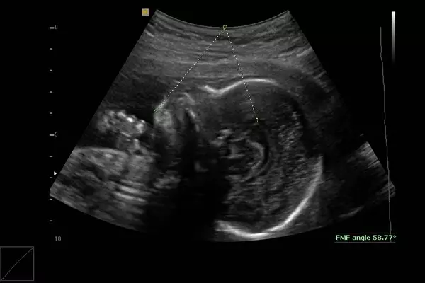 甘願墮胎2次!她忘送未來婆婆「三節禮物」秒被甩 男友渣爆:在家工作要低頭