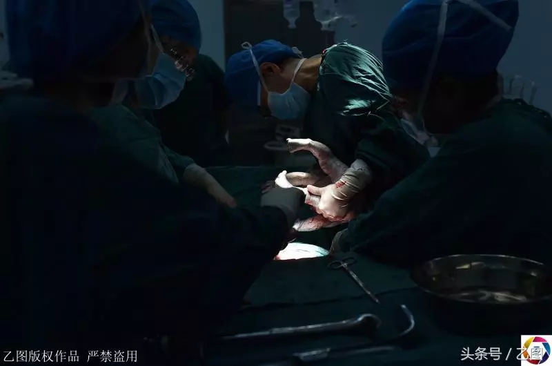 29歲婷婷,年輕媽媽生下寶寶再也沒睜開眼睛,家人含淚捐器官,讓5人獲新生