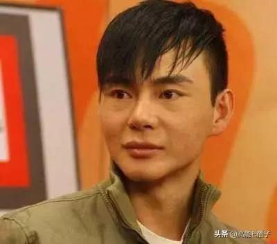 49歲陳浩民公開打針微調照片,這些男星都承認自己嘗試過醫美
