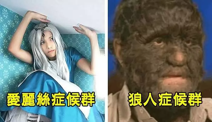 盤點10種「科學無法解釋的怪異病狀」,#9每天醒來都以為自己是殭屍…