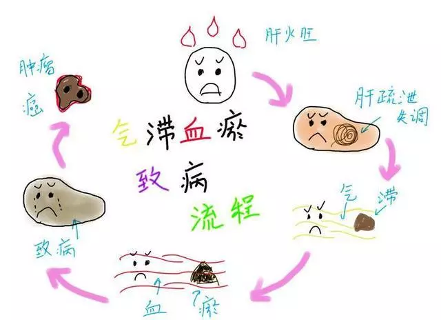 百病之源,血瘀症!千萬不要輕視,看看有你嗎