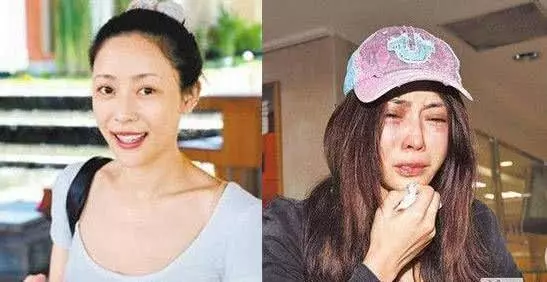 女星遭51歲富商男友家暴,打成腦震蕩頭骨骨折還吐血慘不忍睹~