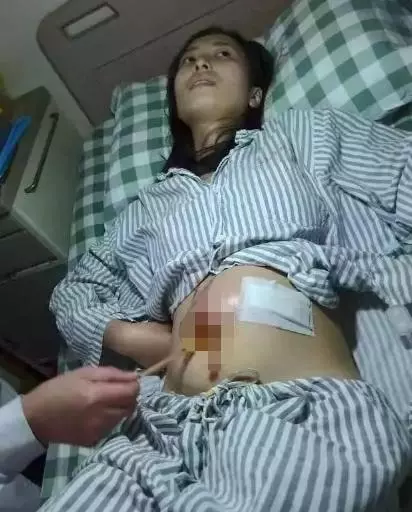 23歲女生腹大如球,一上救護車,醫生就說「不用救了」!女人都要小心…