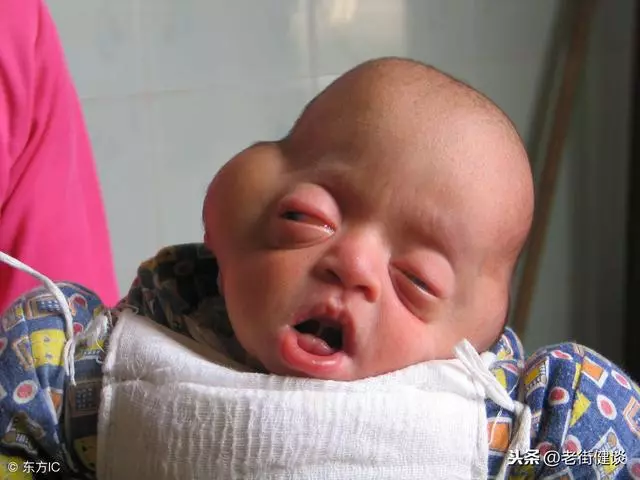不要這樣搖晃嬰兒,每年有受害者!
