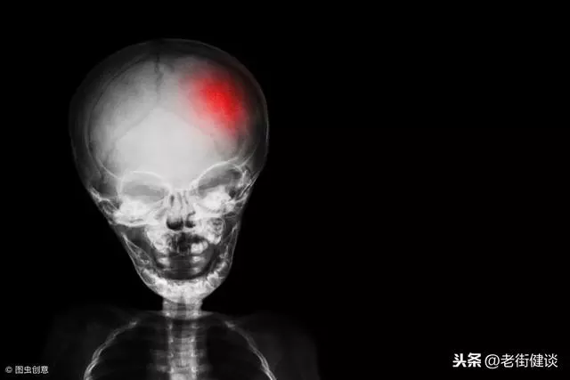 不要這樣搖晃嬰兒,每年有受害者!