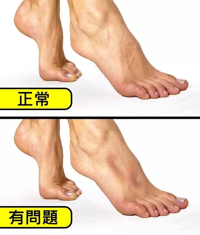 7個只要1分鐘就完成的「超簡單自我健康檢測法」!#1 大拇指3秒鐘!