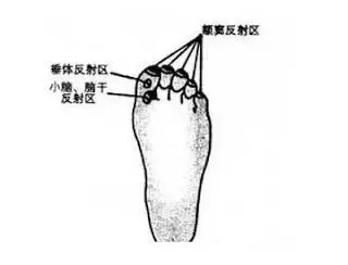 老年癡呆很可怕,預防原來這麼簡單,99%的人不知道!