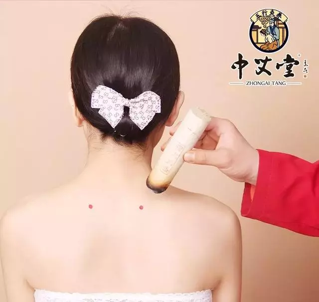 人體八會穴,艾灸調理臟腑問題的要穴(專業必備)