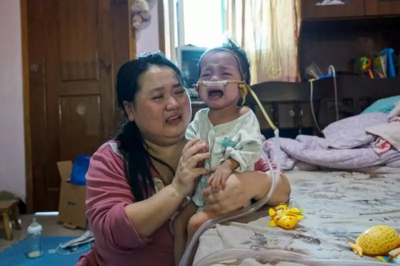 2歲寶寶患重症似嬰兒般大小,靠一台呼吸機活著:一定要撐到5歲