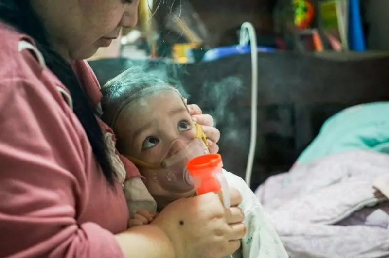 2歲寶寶患重症似嬰兒般大小,靠一台呼吸機活著:一定要撐到5歲