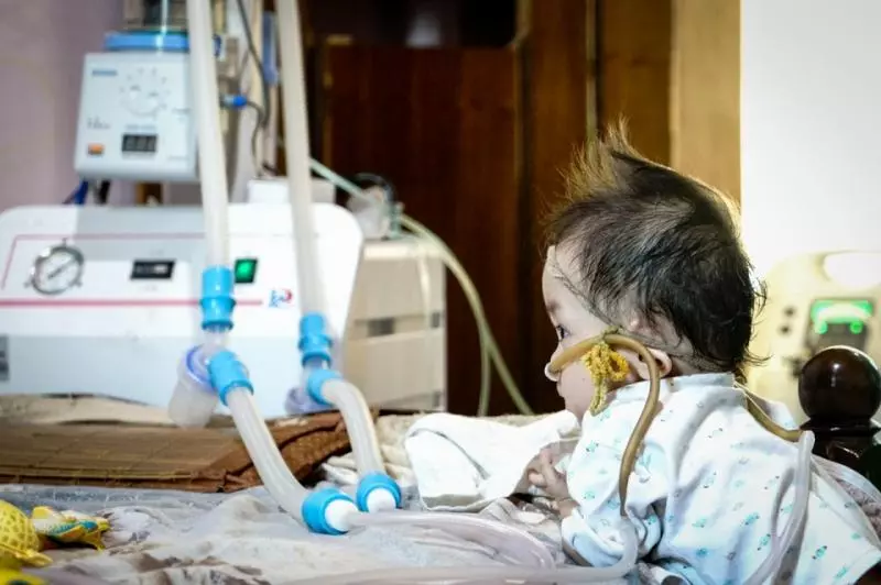 2歲寶寶患重症似嬰兒般大小,靠一台呼吸機活著:一定要撐到5歲