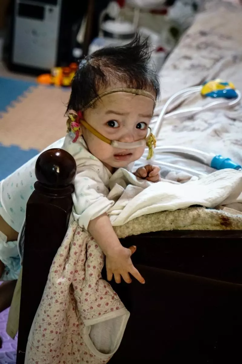 2歲寶寶患重症似嬰兒般大小,靠一台呼吸機活著:一定要撐到5歲