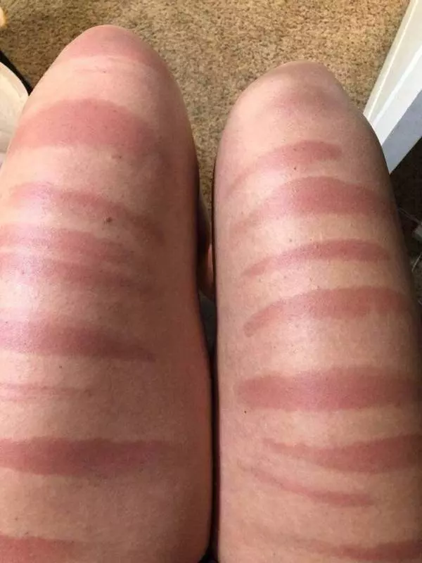22張最糟糕的情況~~~##2 生死就在一瞬間閃過~