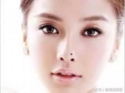 臉上這6個部位長痣的人,旺家興財,容易富貴!